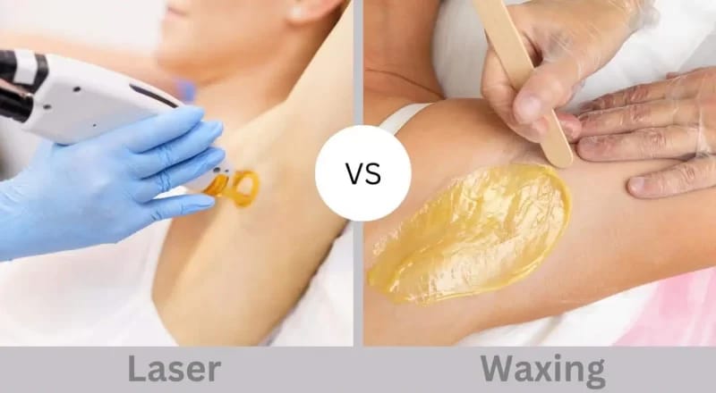 Waxing vs Laser Hair removal – What’s Better for You